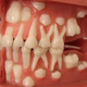 Illustration for article titled PEDIATRIC DENTISTS IN BANGALORE